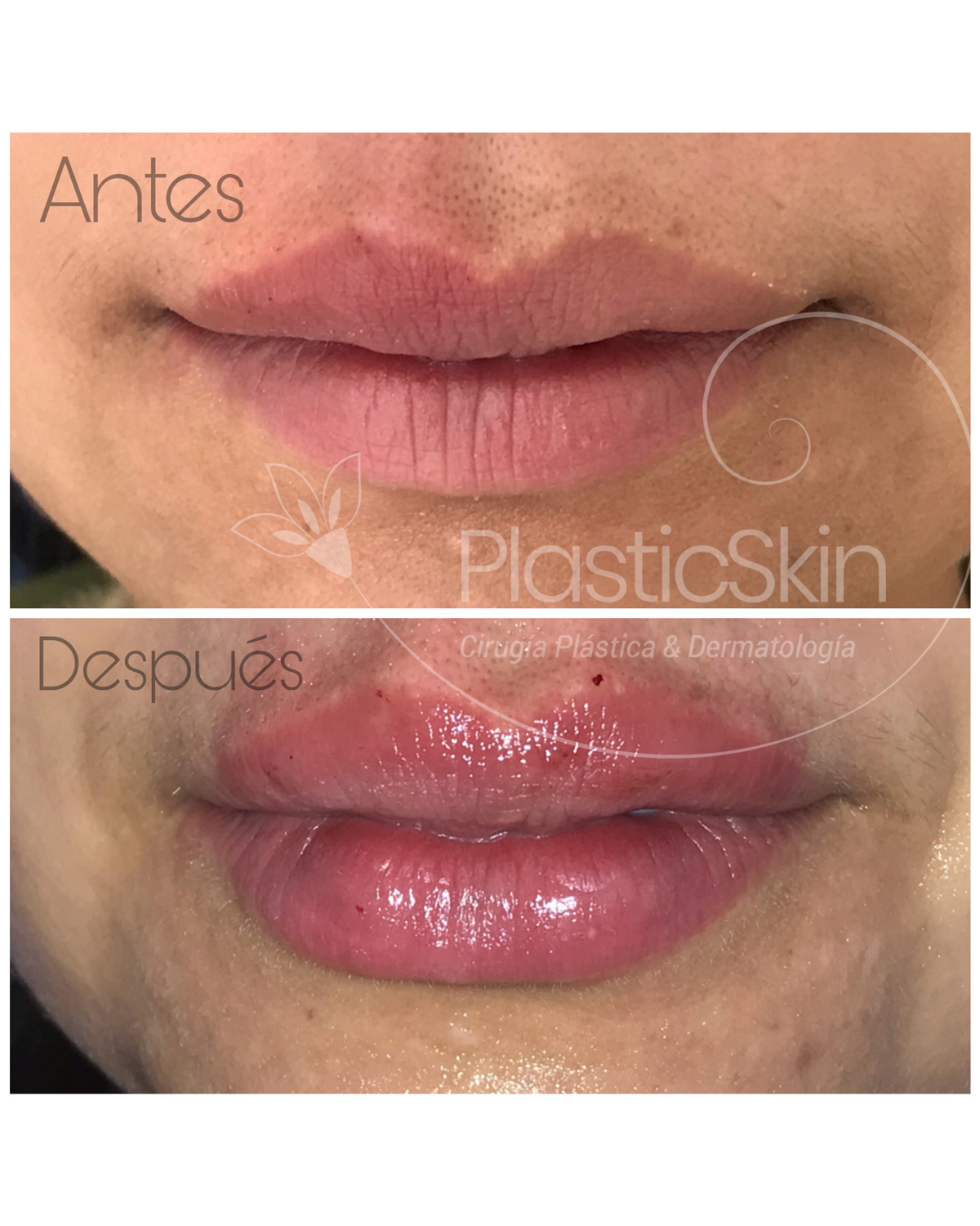 Lips