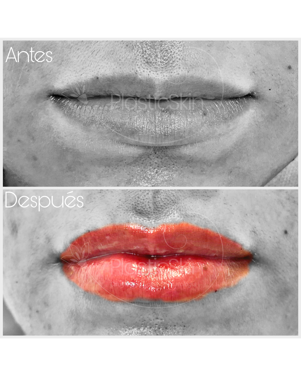 Lips